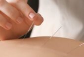 Acupuncture Treatment