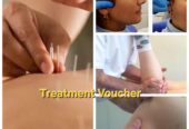 Acupuncture Treatment