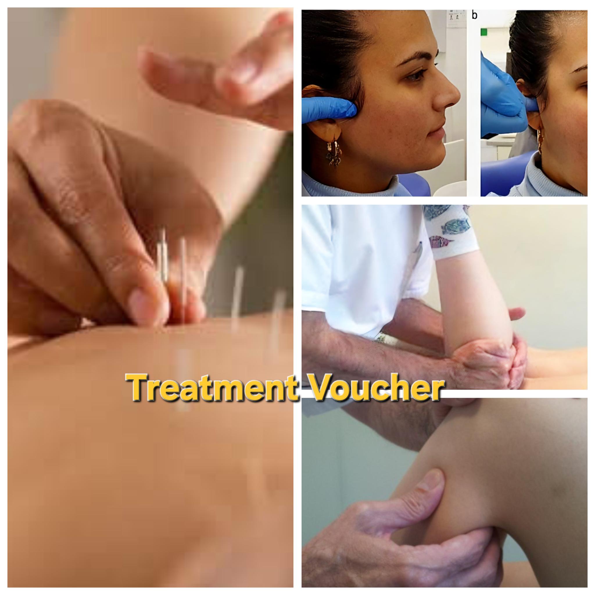 Acupuncture Treatment